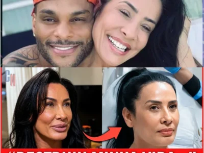 CANSADA DA APARÊNCIA ARTIFICIAL, SCHEILA CARVALHO REMOVE A HARMONIZAÇÃO E DESABAFA… -H